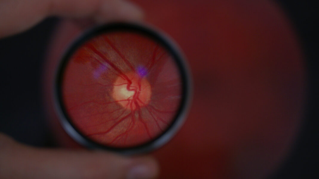 L’intelligence artificielle au service du dépistage médical : l’ÉTS et DIAGNOS créent une nouvelle chaire de recherche L’intelligence artificielle au service du dépistage médical : l’ÉTS et DIAGNOS créent une nouvelle chaire de recherche